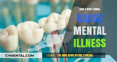 Exploring the Link Between Root Canals and Mental Health Concerns