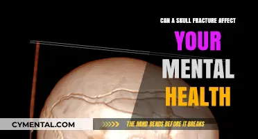 Exploring the Impact of Skull Fractures on Mental Health