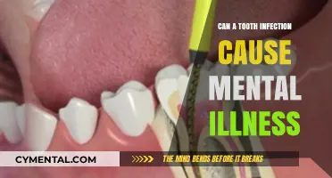 Exploring the Link: Can Tooth Infections Impact Mental Health?