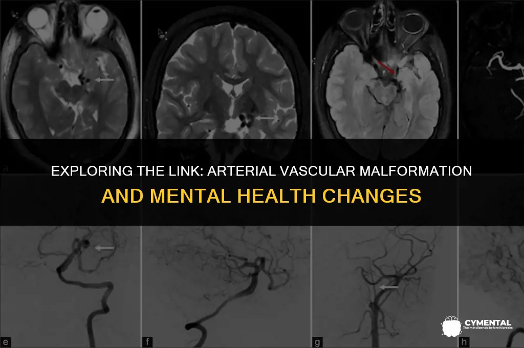 can arterial vascular malformation cause change in mental health