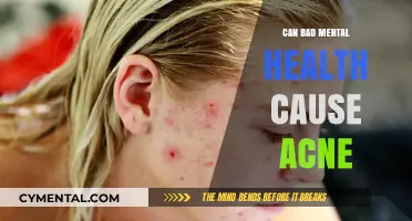 Exploring the Link: Mental Health and Acne Connection