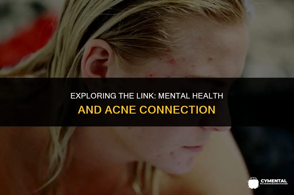can bad mental health cause acne
