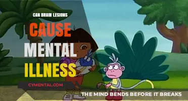 Exploring the Link: Brain Lesions and Mental Health