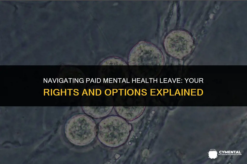 can i get paid for mental health leave