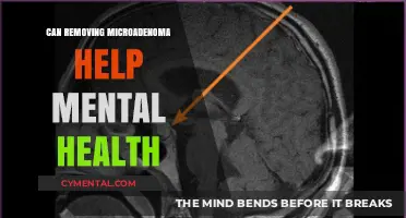 Microadenoma Removal: A Potential Boost for Mental Health?