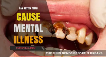 The Surprising Link Between Dental Health and Mental Well-being