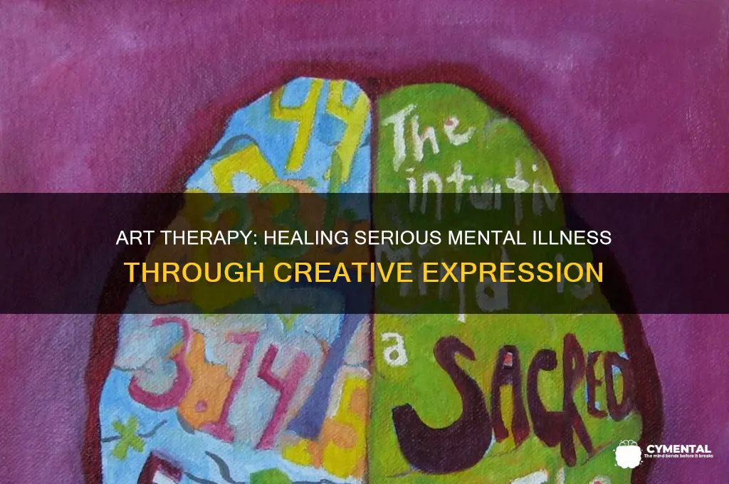 how is art therapy helpful for serious mental illness