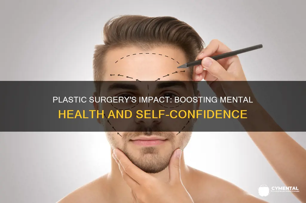 how plastic surgery helps mental health