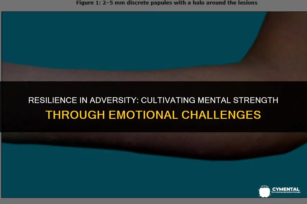 how to be strong mentally when someone hurts you