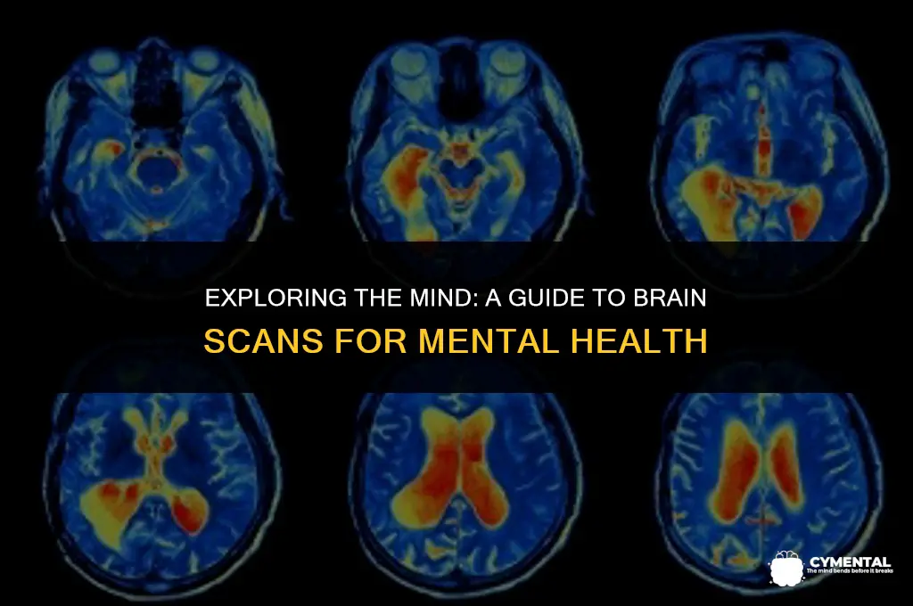 how to get a brain scan for mental illness