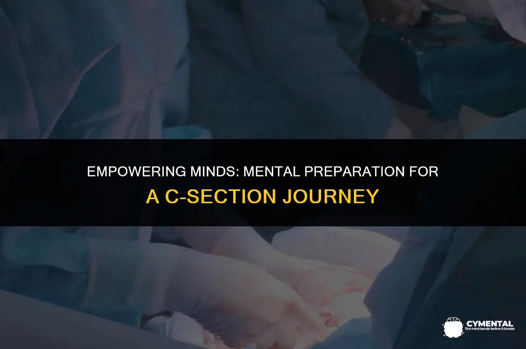how to mentally prepare for c section
