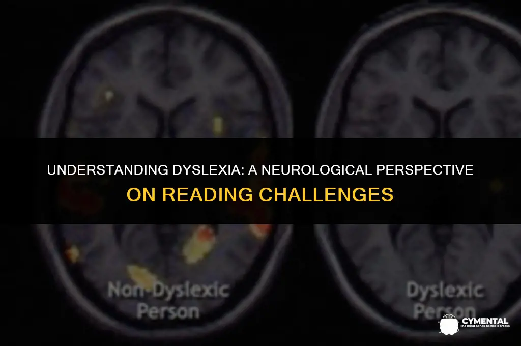 is dyslexia a mental disorder