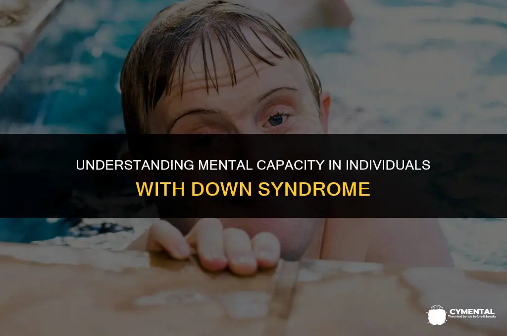 what is the mental capacity of someone with down syndrome
