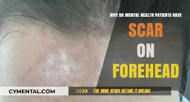 Understanding Forehead Scars in Mental Health Patients: A Compassionate Look