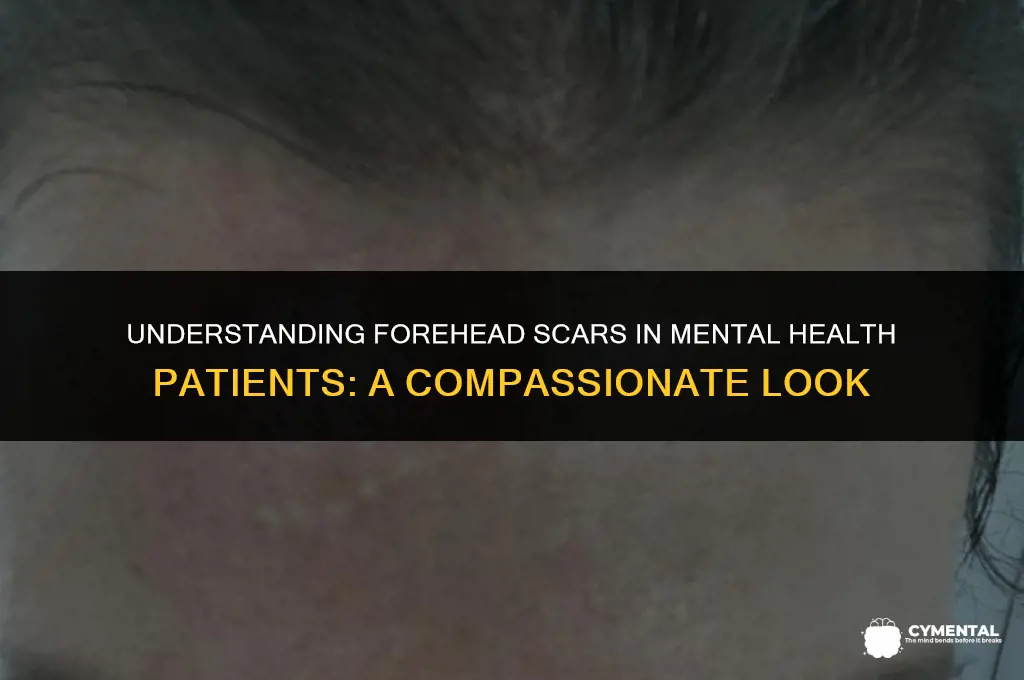 why do mental health patients have scar on forehead